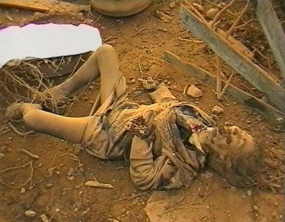 Yugoslavian victim of humanitarian bombing